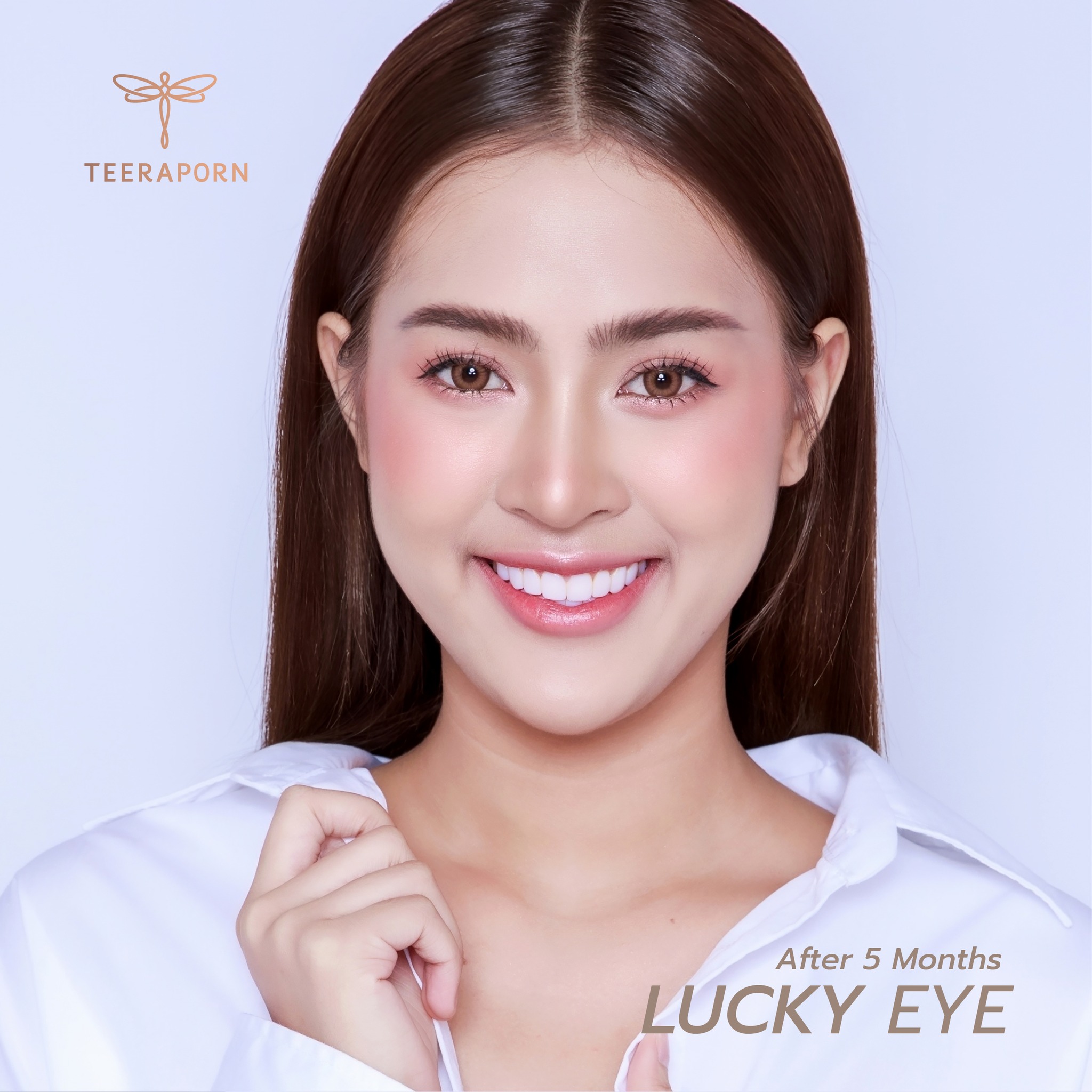 ตาสองชั้นธรรมชาติ
