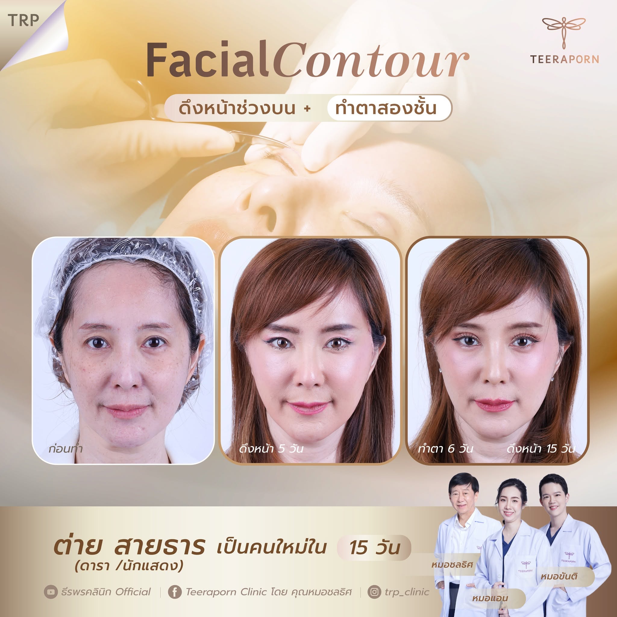facial contour