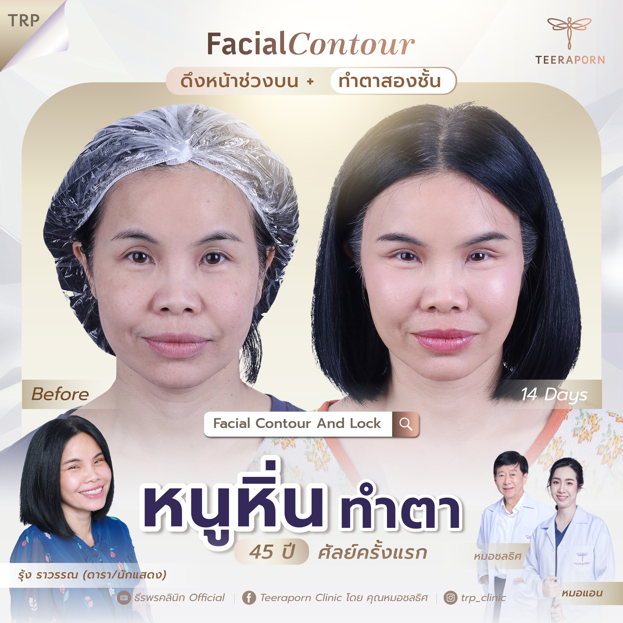 หนูหิ่น