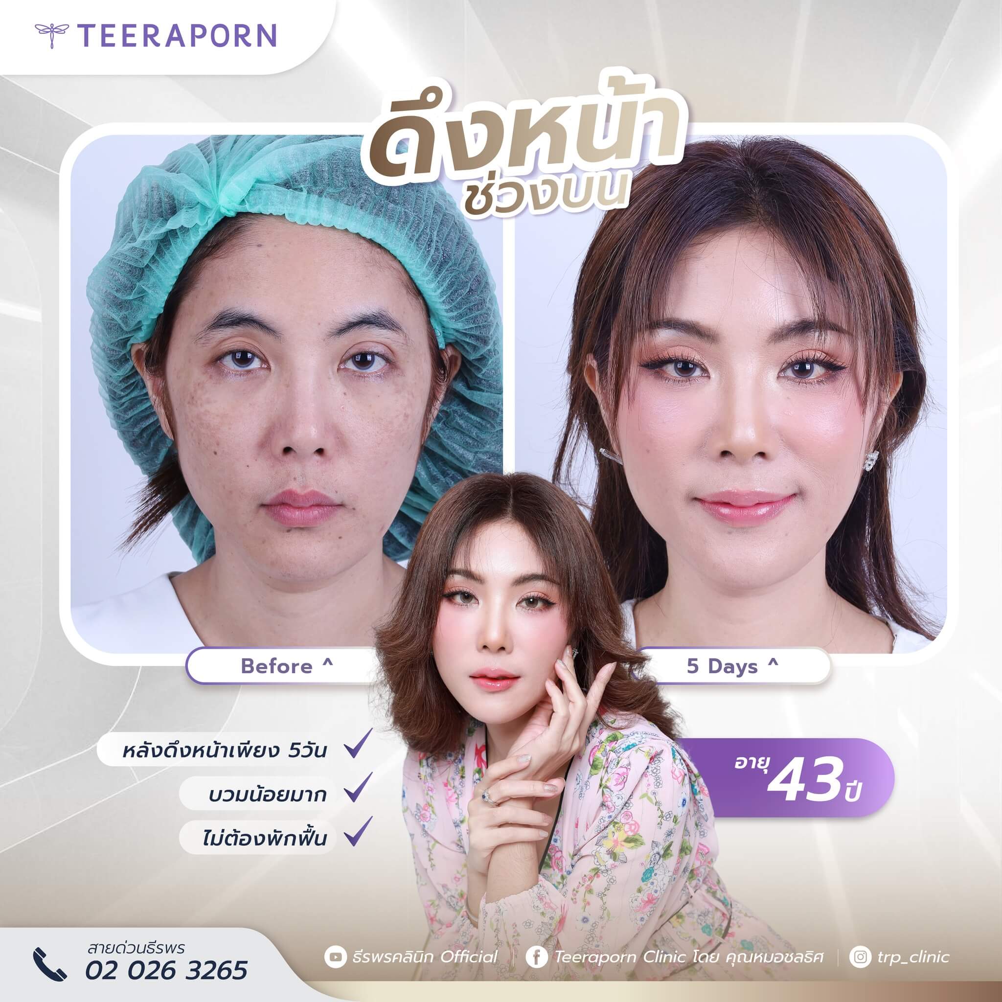 คุณแอน
