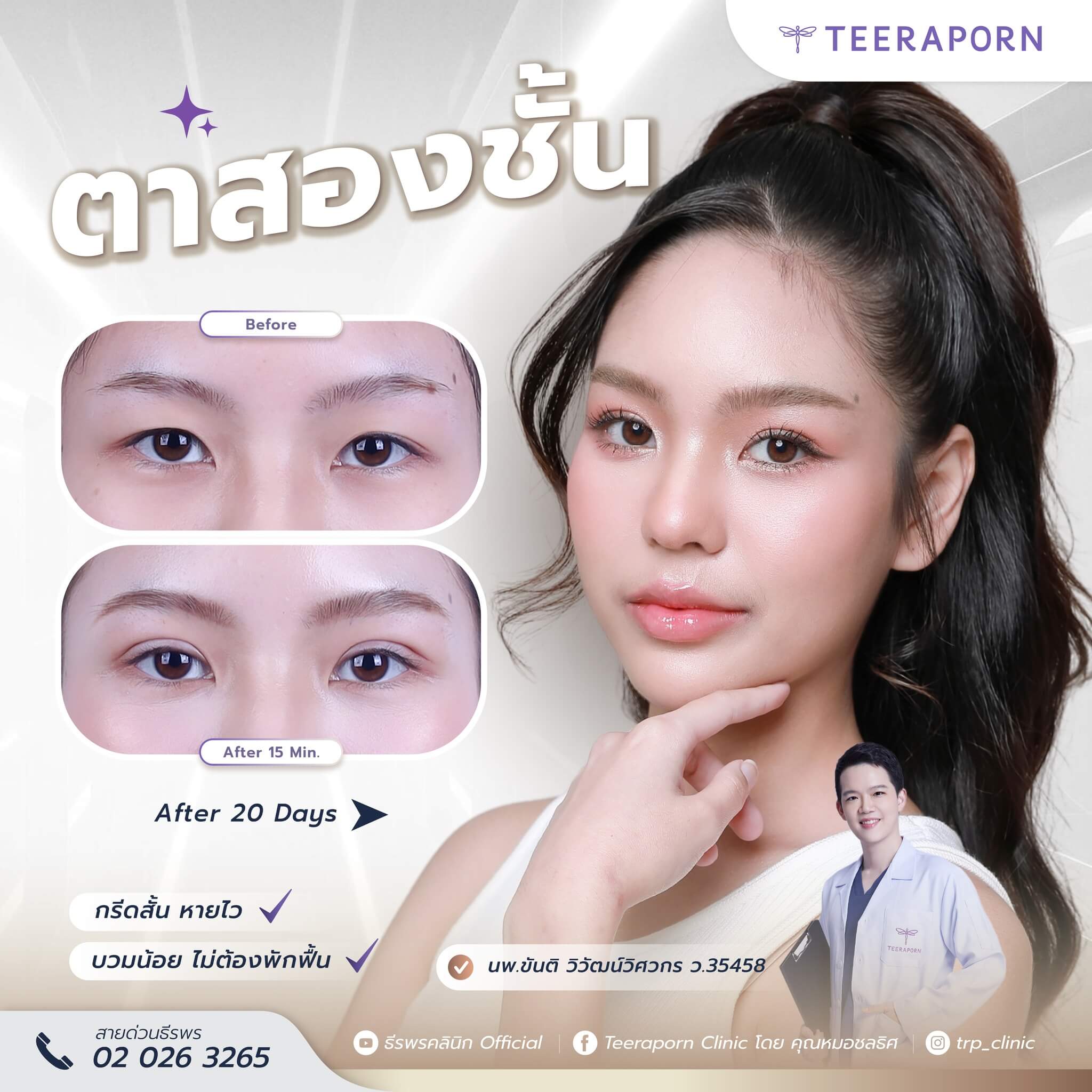 ตาชั้นเดียว ตาสองชั้น