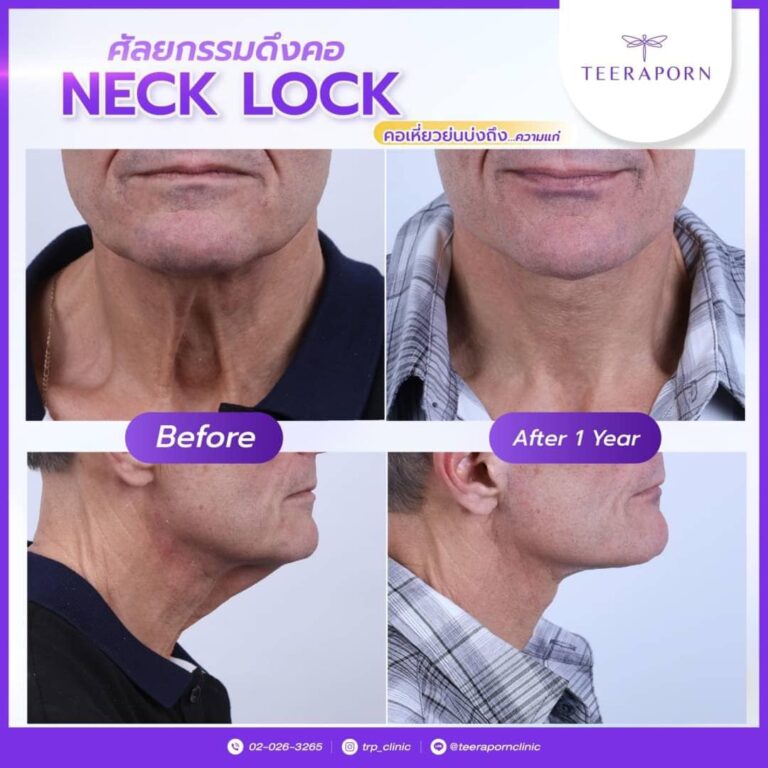 326456318_5907709619275796_115577708011136388_n-768x768