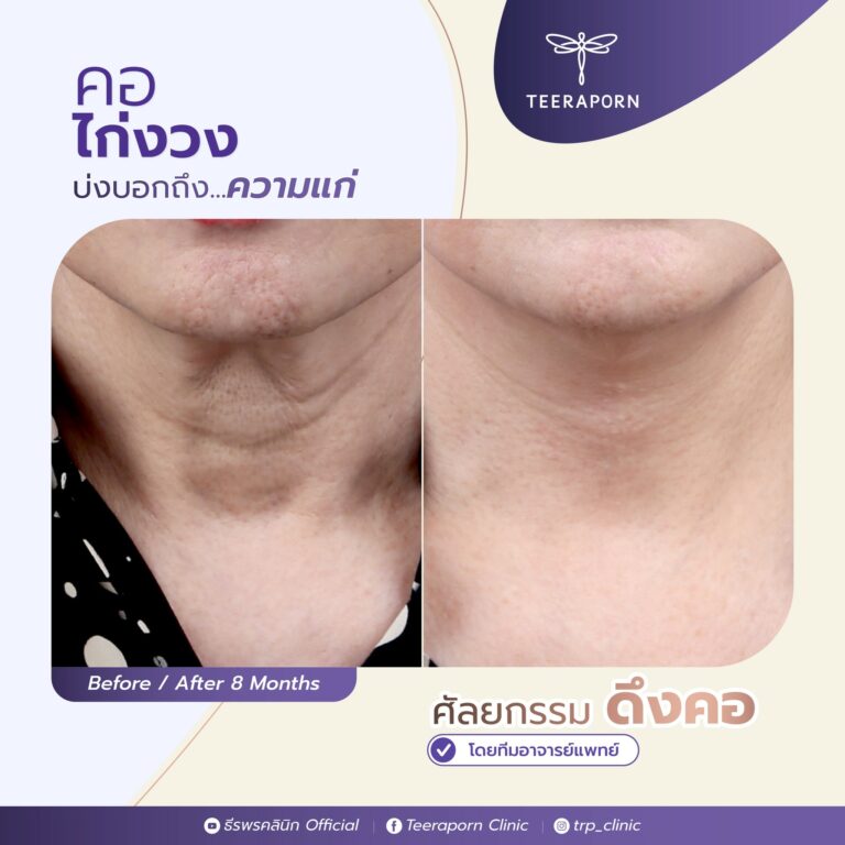 383223743_642890451376887_2235021521470026344_n-1-768x768