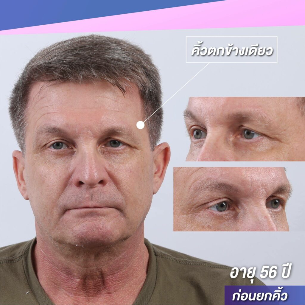 48381928_1888138451312210_5882538258306433024_n-1024x1024