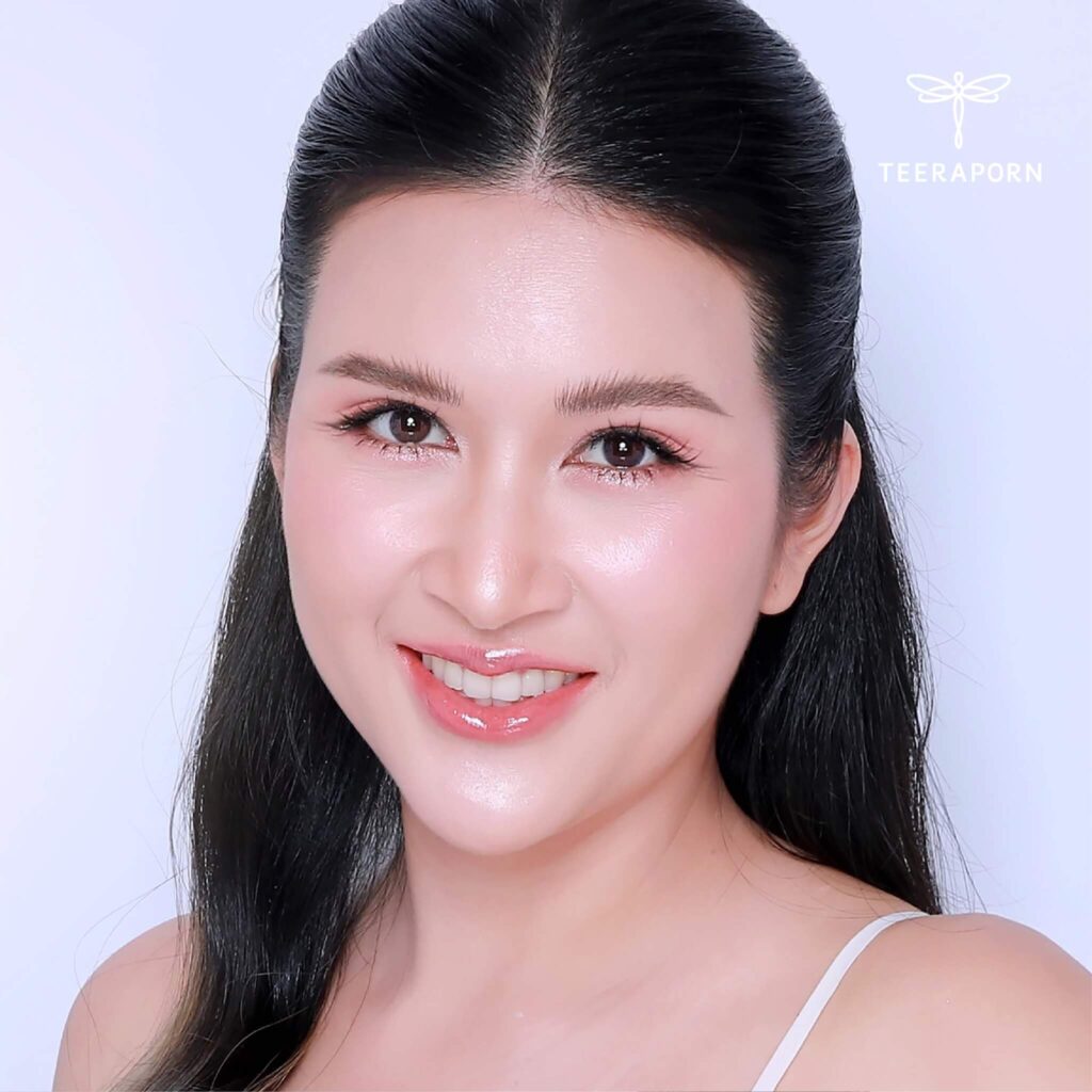 เอนโดไทน์ รีวิว