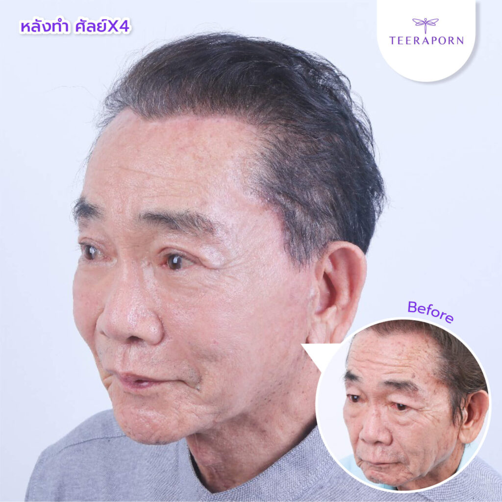 เฮียกุล