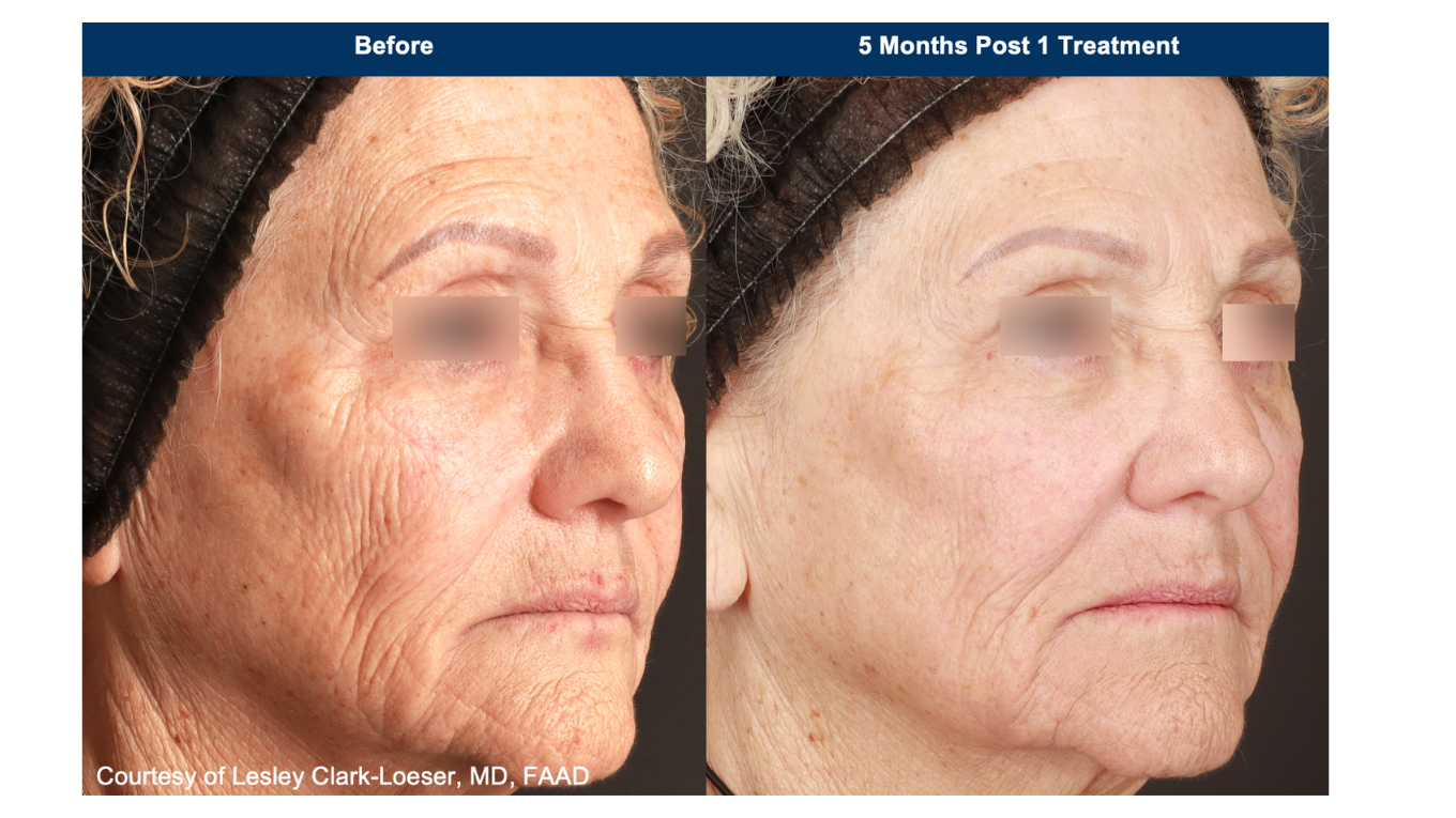 Beforeafter-Biesman-PDF-3