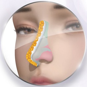 ซิลิโคน+multi cell