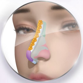 ซิลิโคน+multi cell+เนื้อเยื่อเทียม