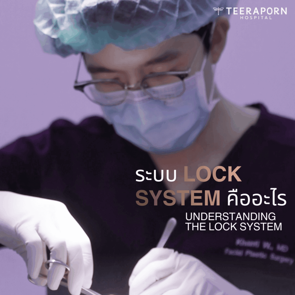 What is the Lock System? Discover How It Differs from Other Techniques