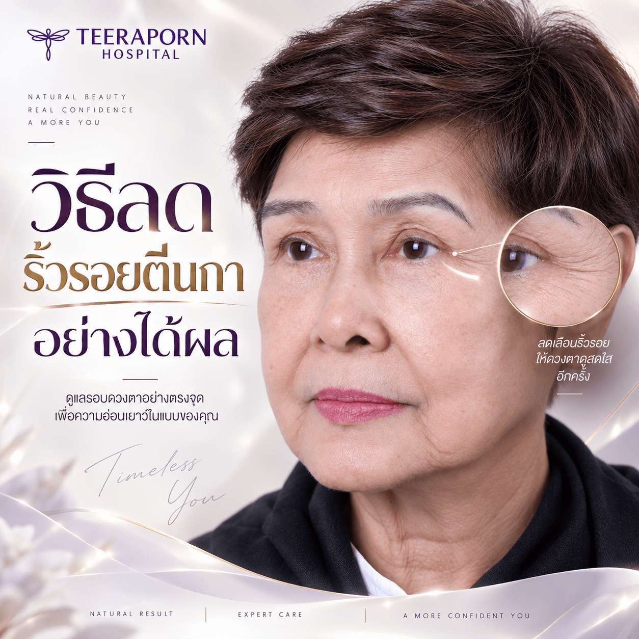 วิธีลดริ้วรอยตีนกาอย่างได้ผล
