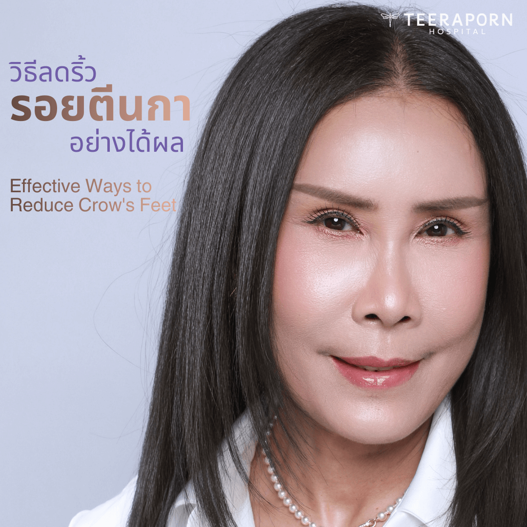 วิธีลดริ้วรอยตีนกาอย่างได้ผล