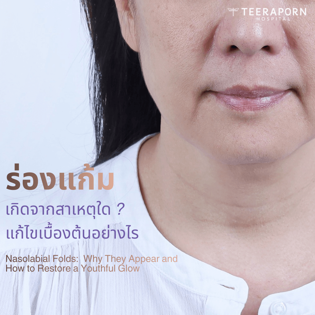 ร่องแก้ม