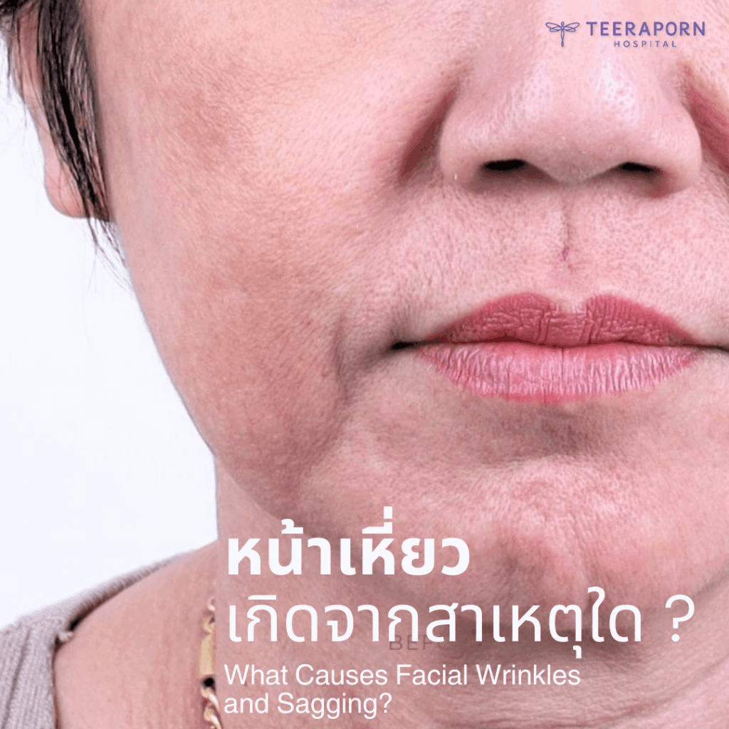 หน้าเหี่ยว