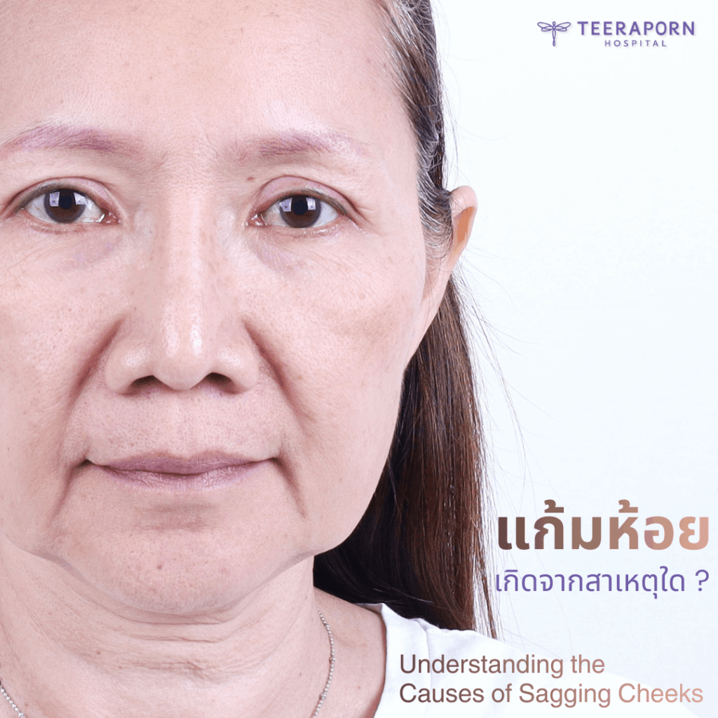 แก้มห้อย