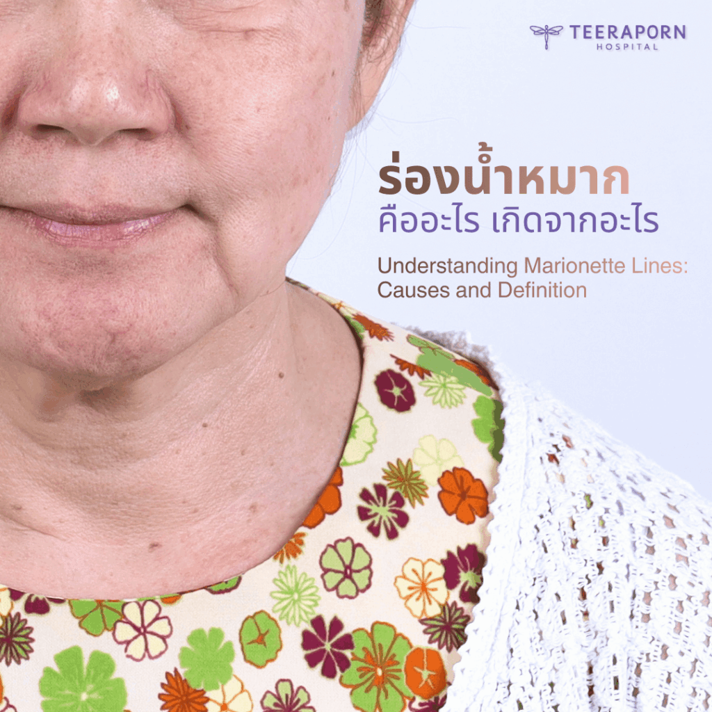 ร่องน้ำหมาก