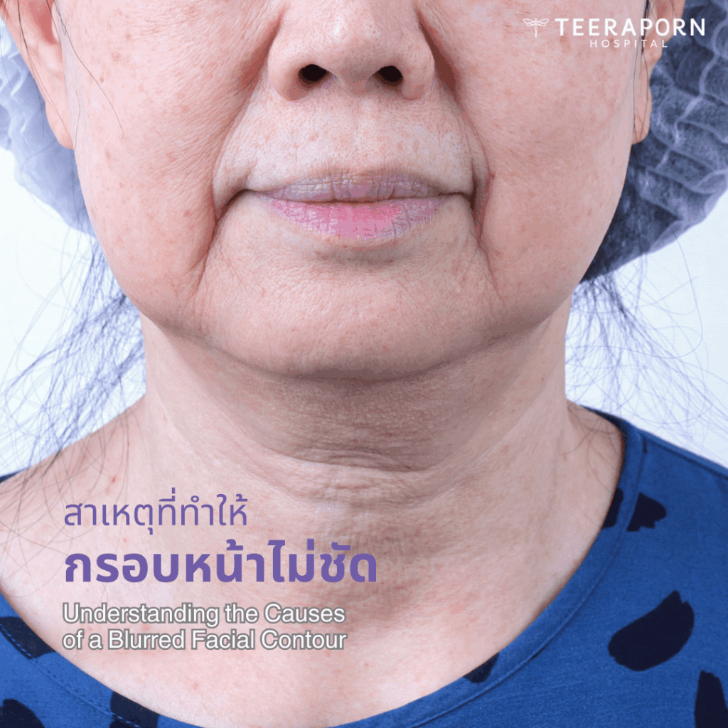 สาเหตุที่ทำให้กรอบหน้าไม่ชัด