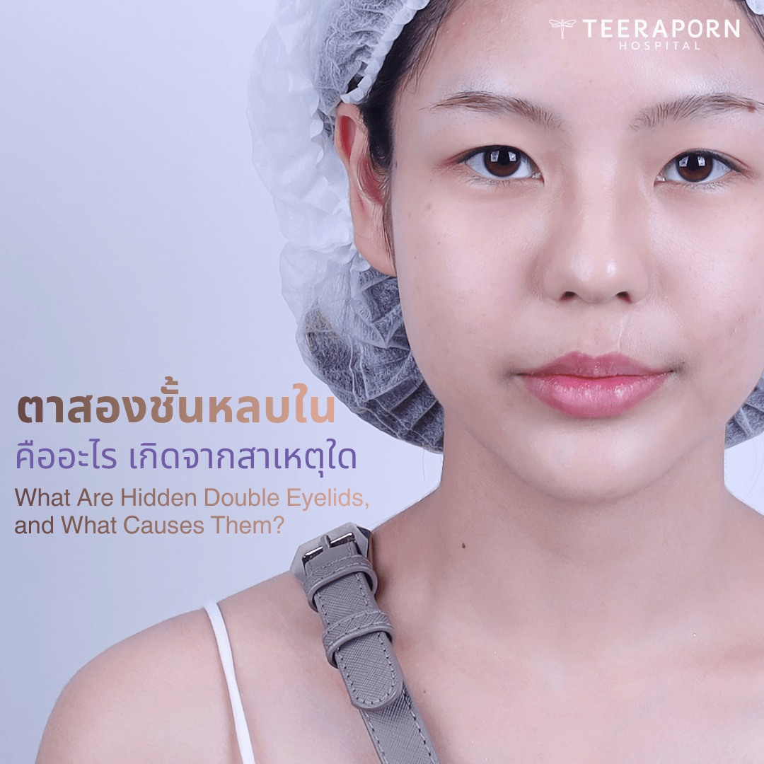ตาสองชั้นหลบใน