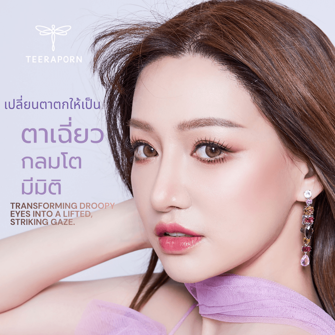 ตาเฉี่ยว