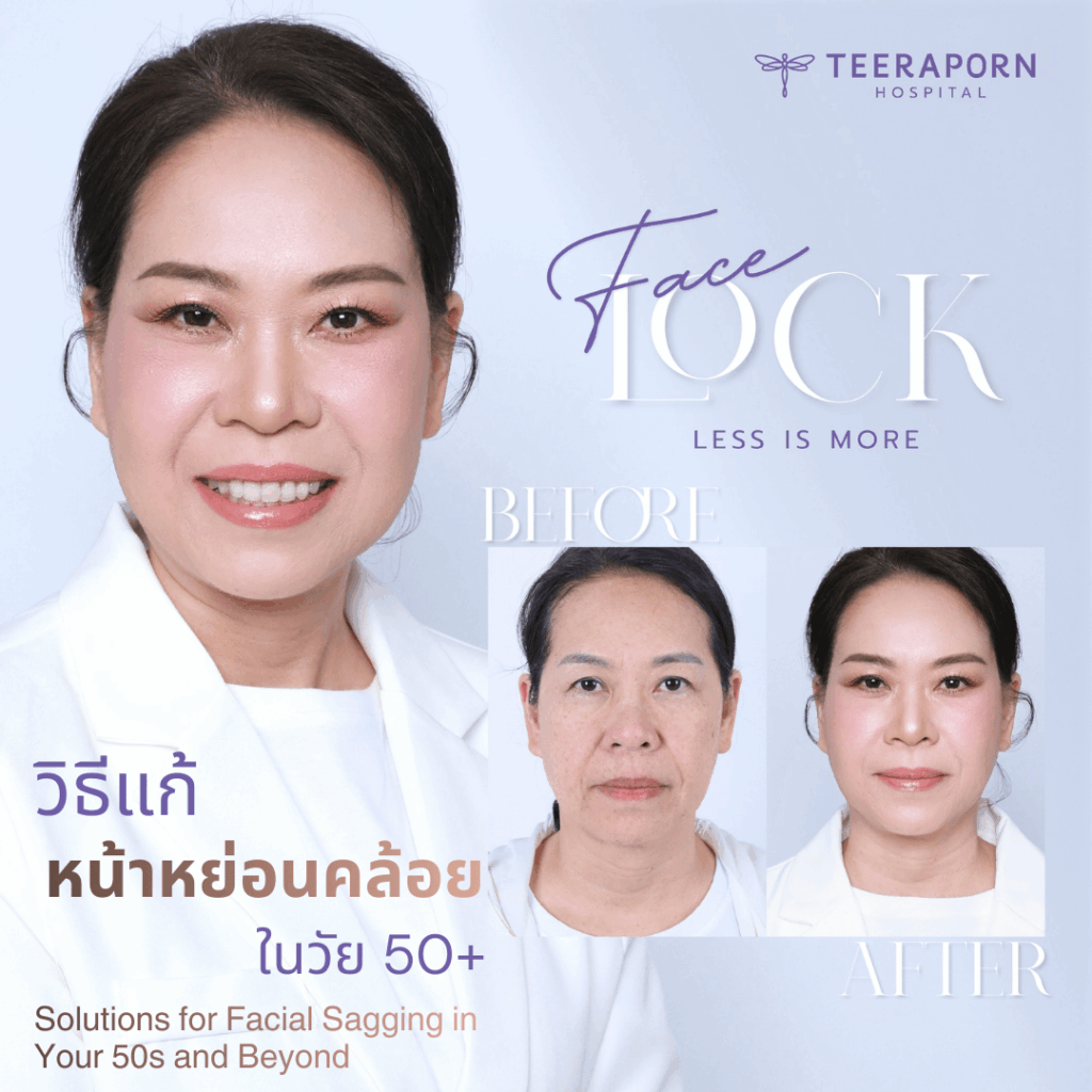 อายุ 50 หน้า หย่อน คล้อย