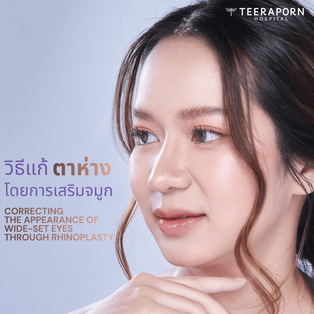 Addressing Wide-Set Eyes