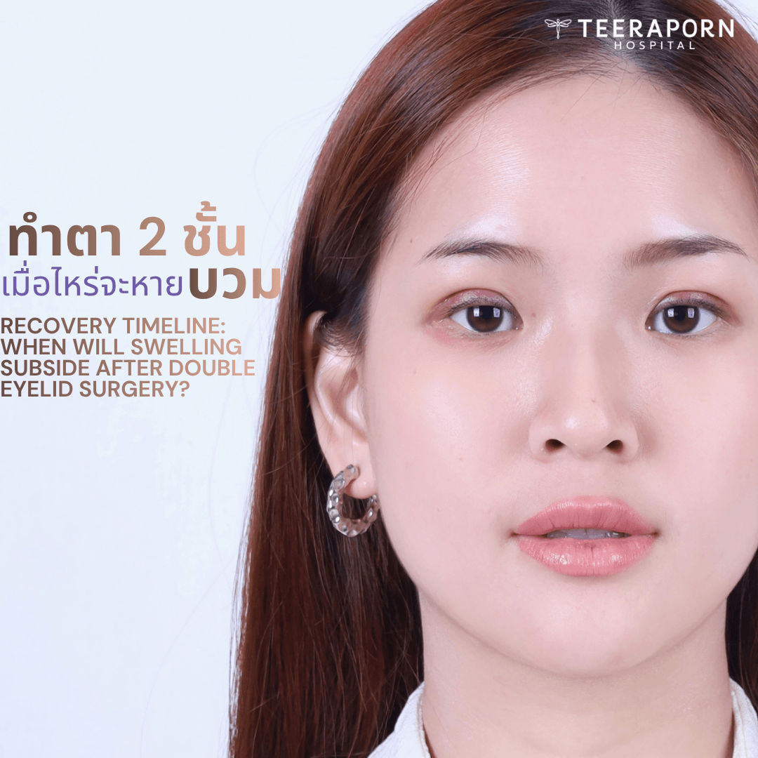 ทำตาสองชั้น บวมนาน