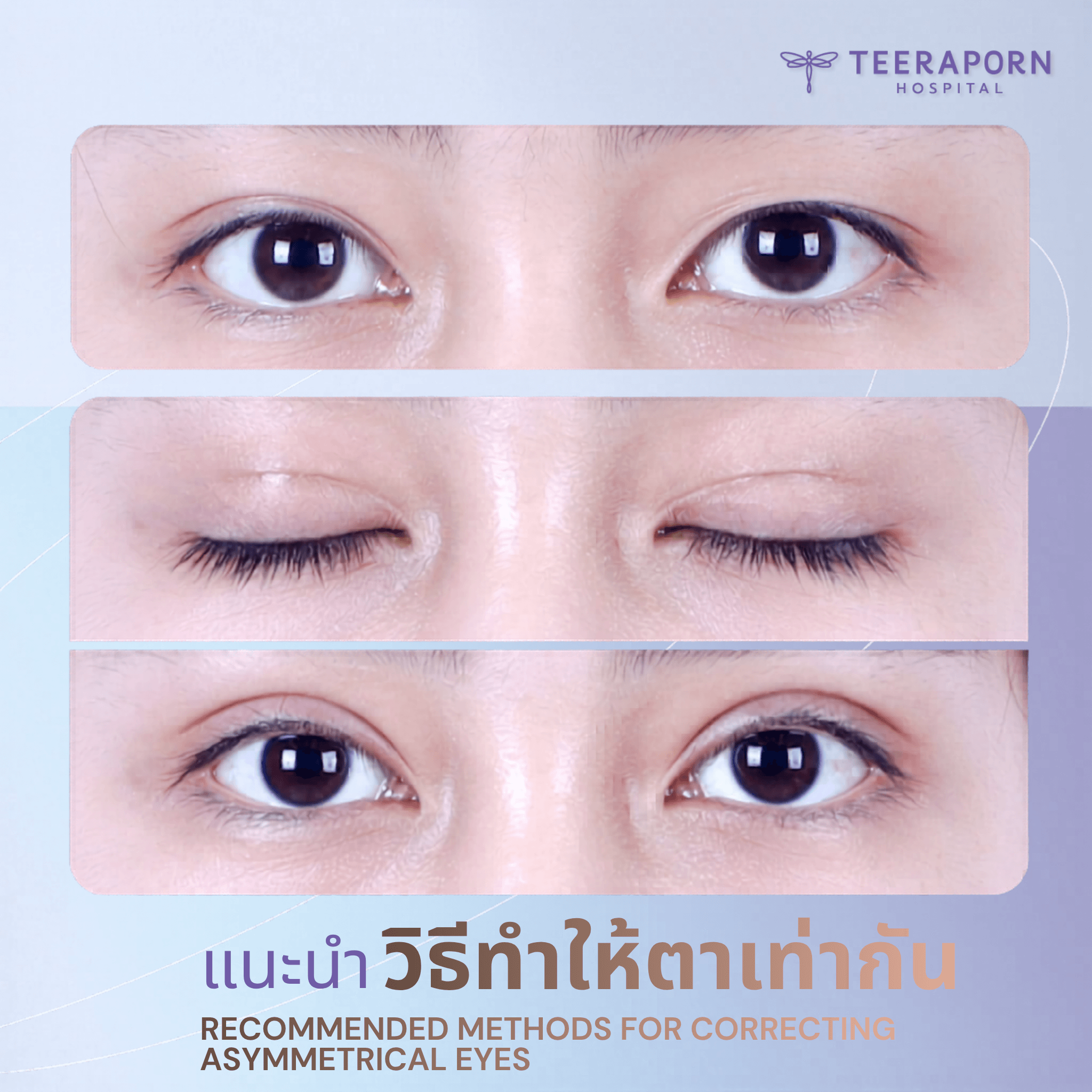 วิธีทำให้ตาเท่ากัน