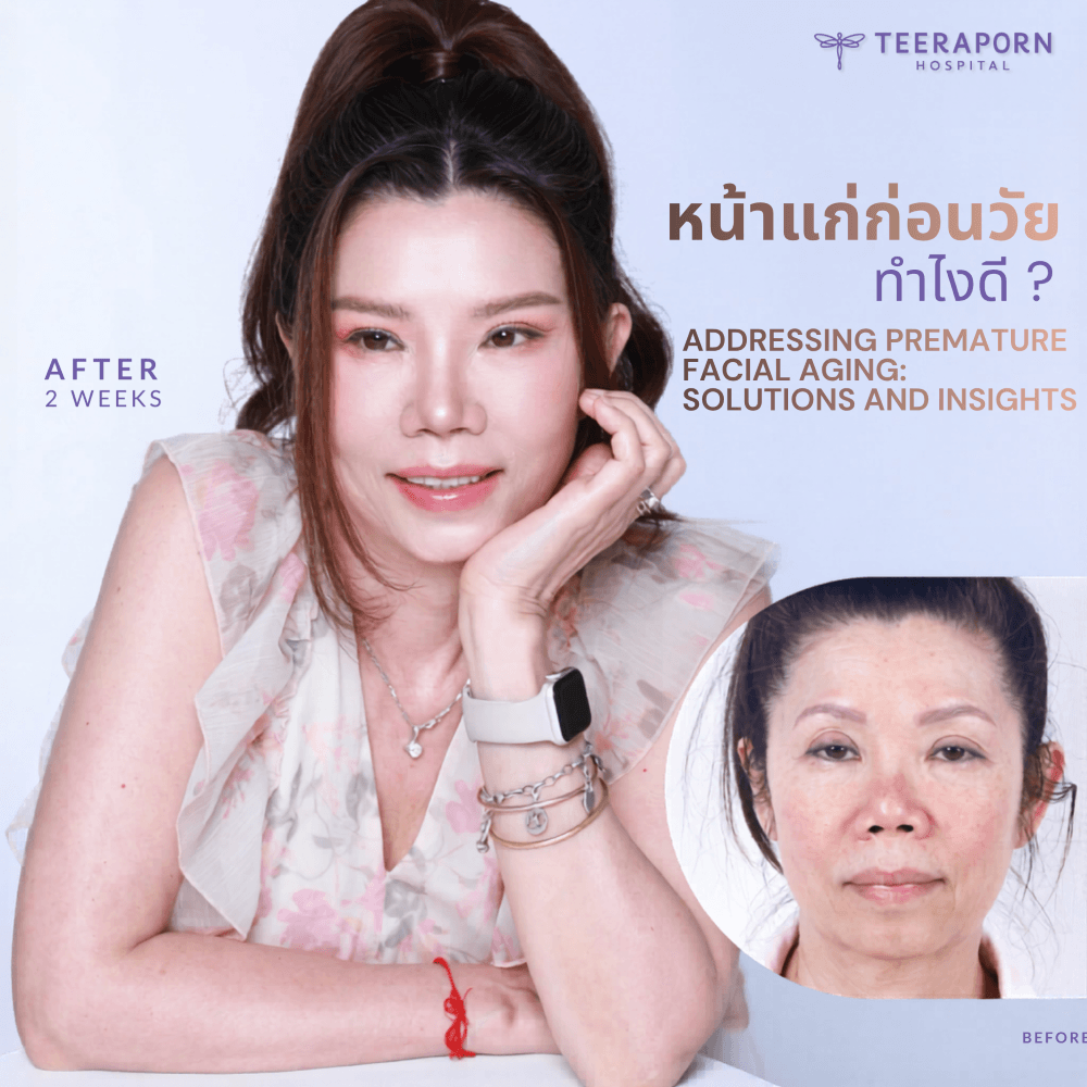 Premature Facial Aging