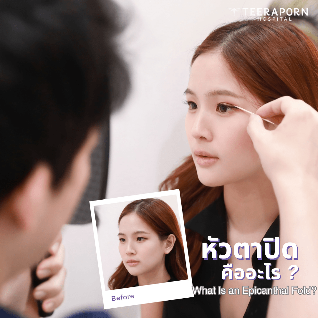 หัวตาปิด