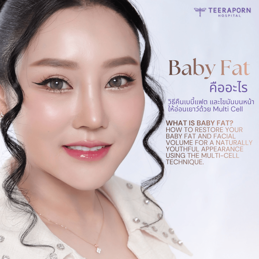 baby fat