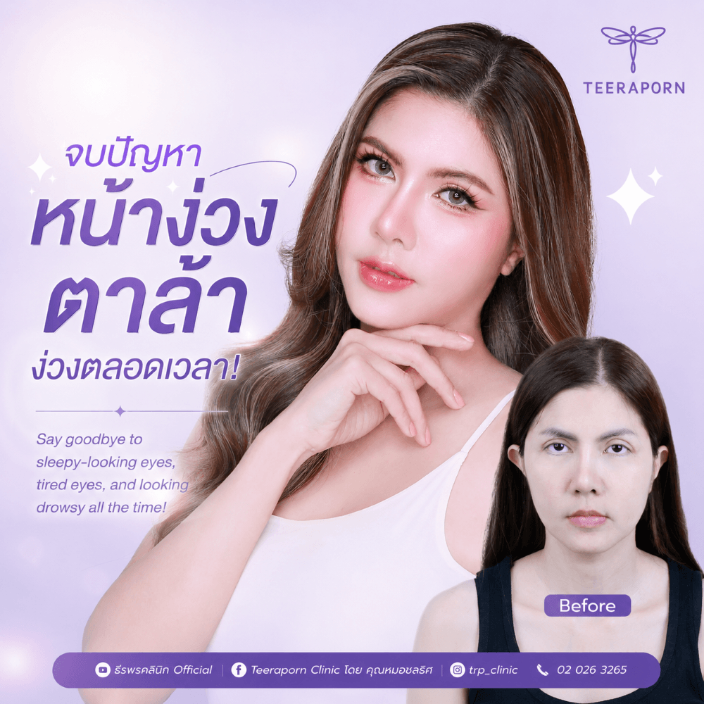 ตาล้า ง่วง ตลอดเวลา