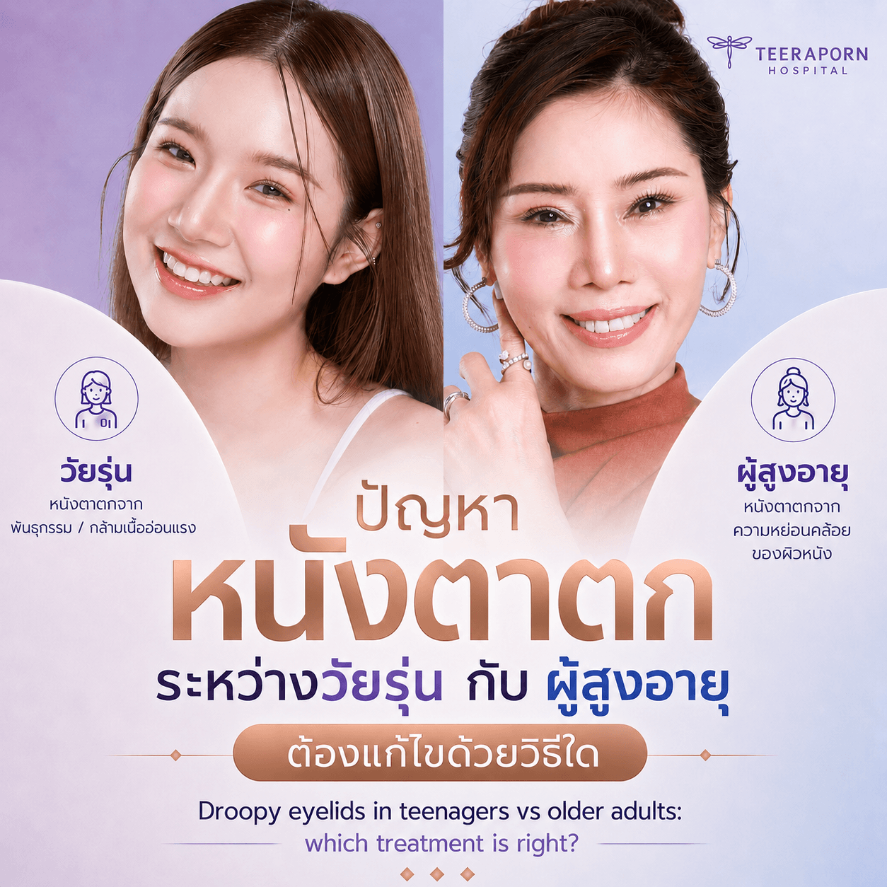 หนังตาตก
