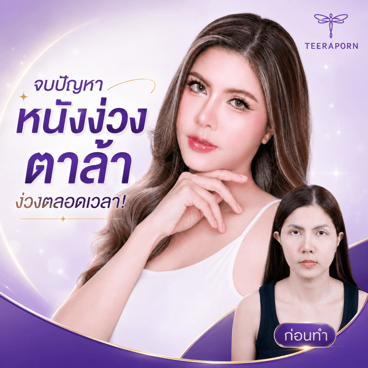 หน้าง่วง ตาล้า