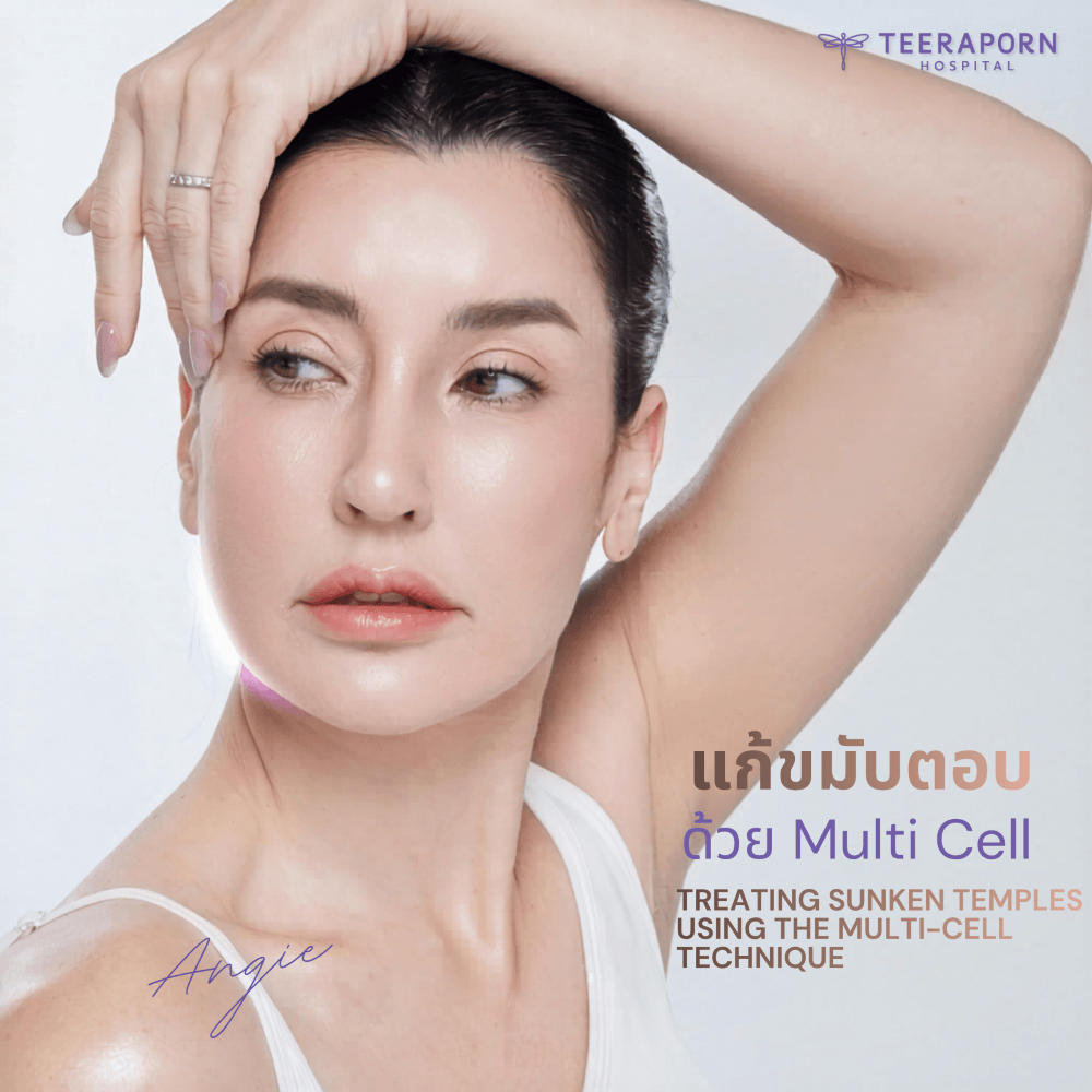 เสริมขมับ