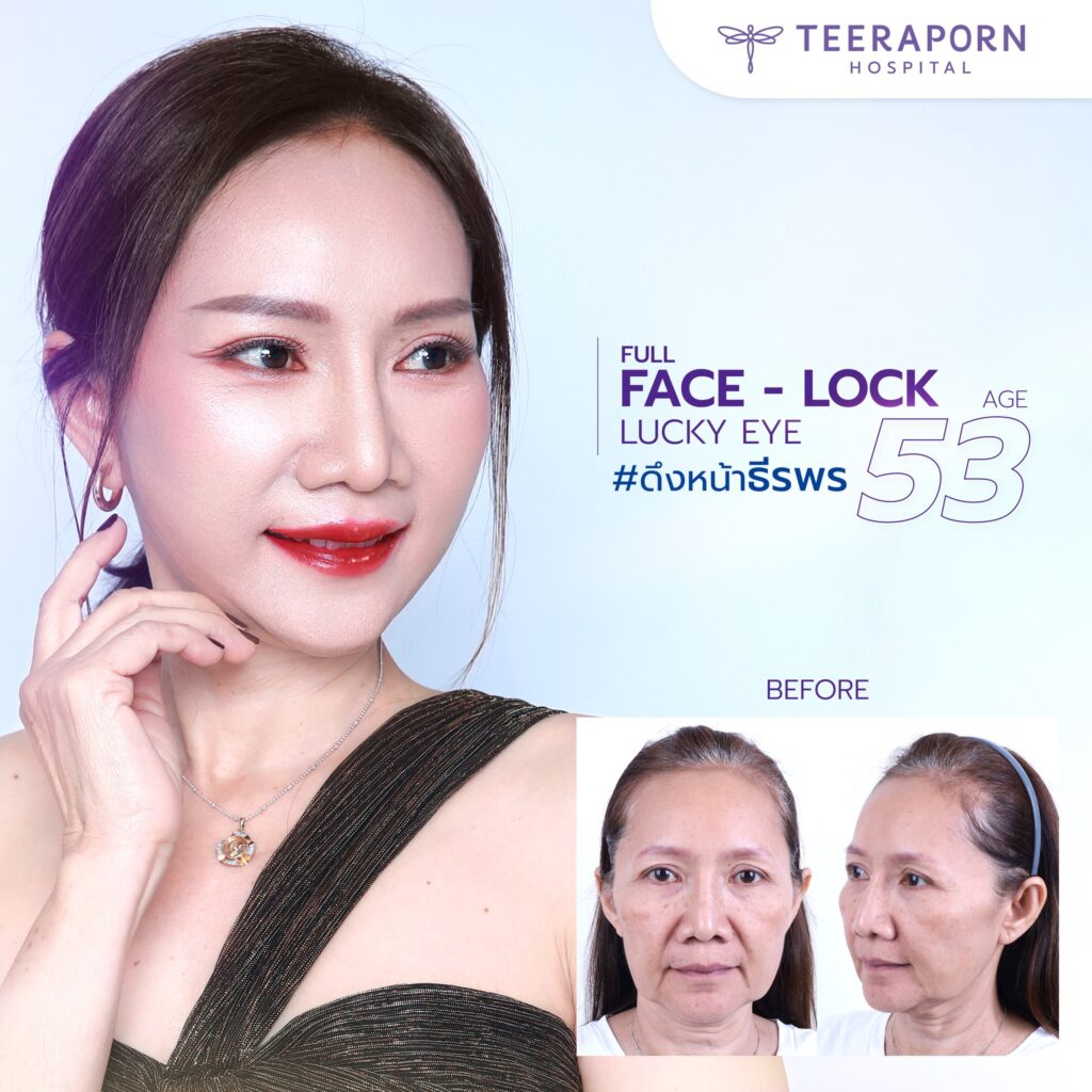 ไม