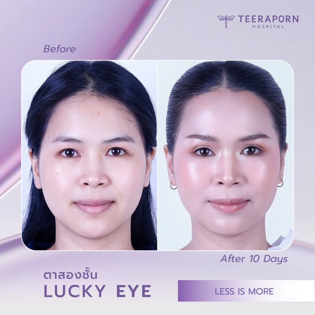 คุณจิลลี่