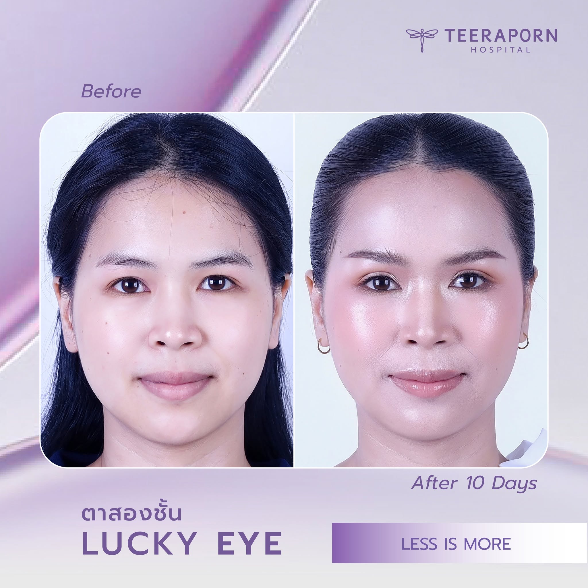 คุณจิลลี่