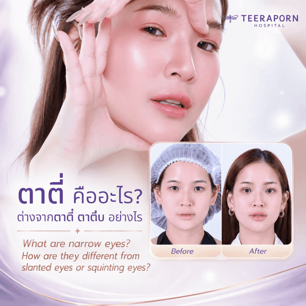 ตาตี่