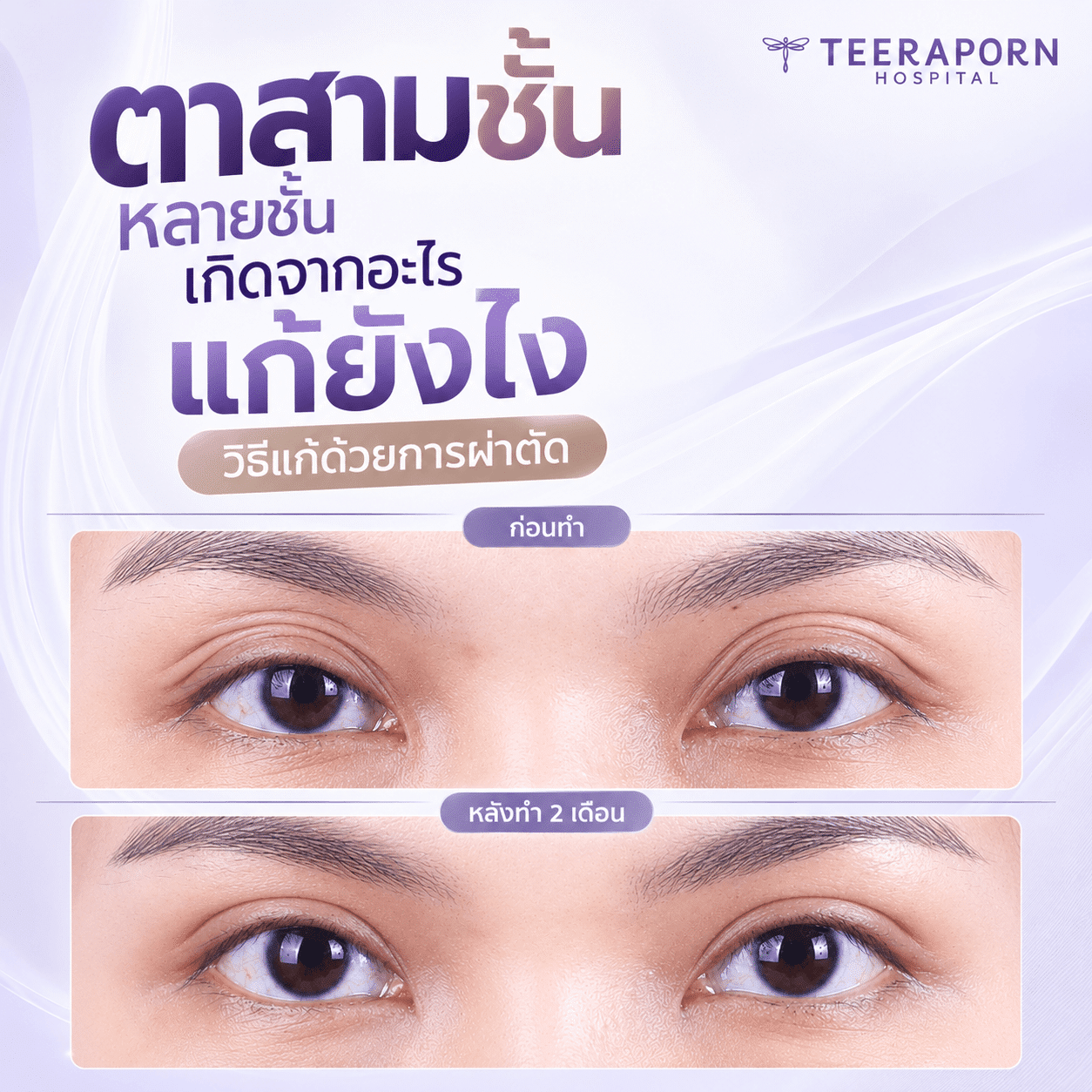 ตาสามชั้น