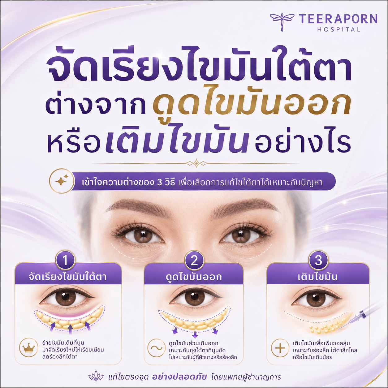 จัดเรียงไขมันใต้ตา