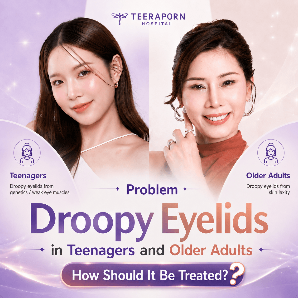 Drooping Eyelids
