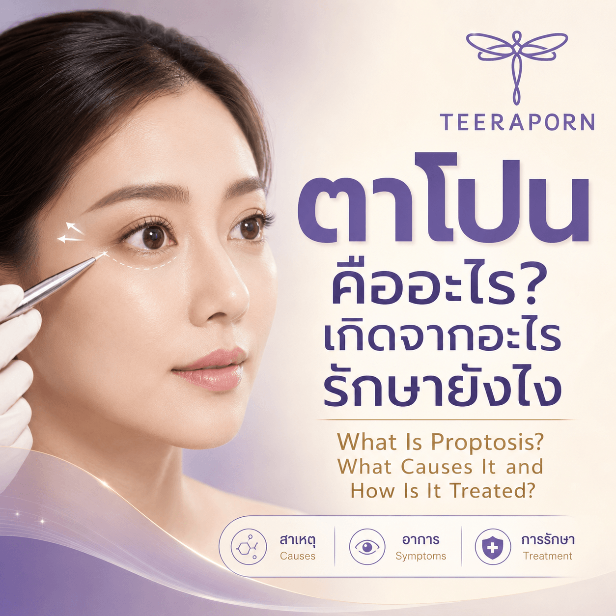 ตาโปน คืออะไร เกิดจากอะไร รักษายังไง