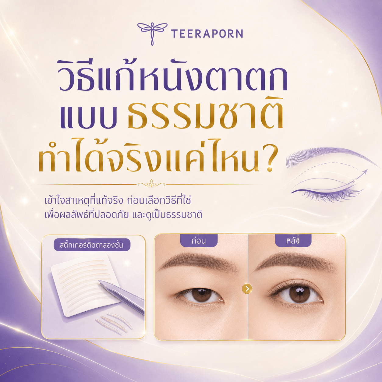 วิธีแก้หนังตาตกแบบธรรมชาติ